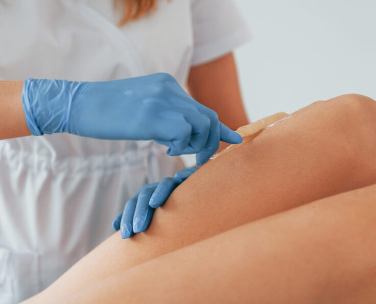 Clean skin on the legs. Woman is having sugaring procedure in the clinic by female doctor.